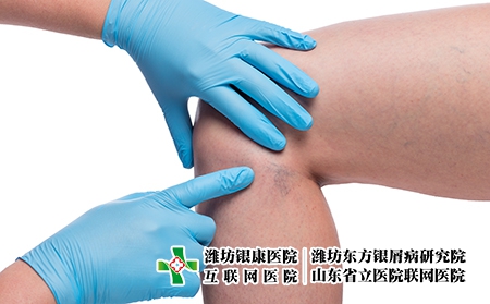 摄图网_303522806_医生亲手检查女腿和紧闭的容器上变血管（企业商用）